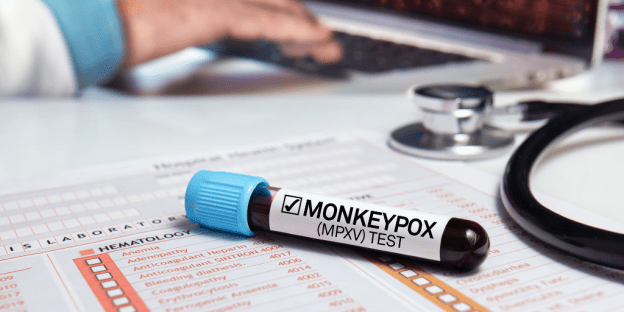 Monkeypox public health emergency